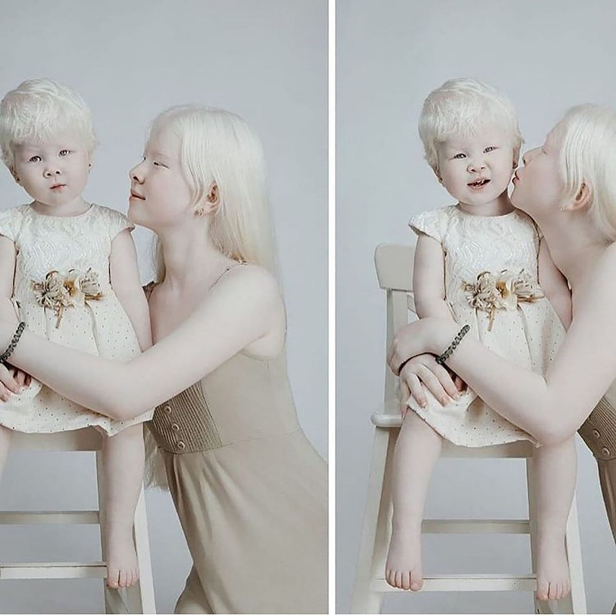 Как люди рождаются альбиносами. Сестры альбиносы из Казахстана.