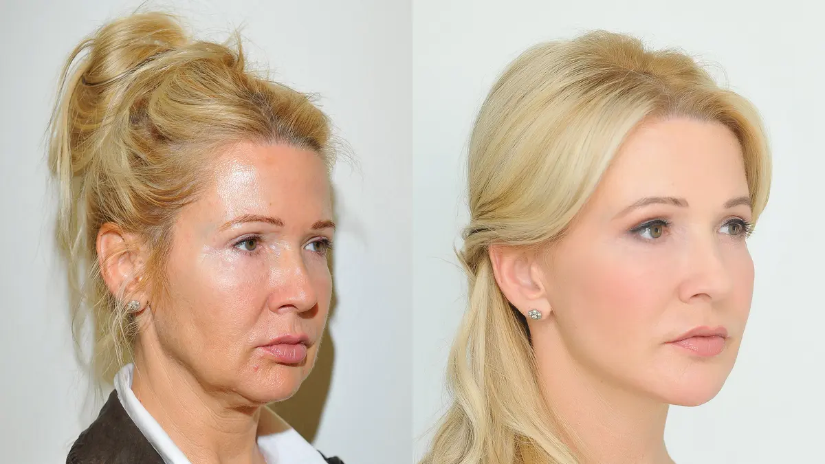 nasa anti aging juice receptek statut transfrontaier suisse anti aging