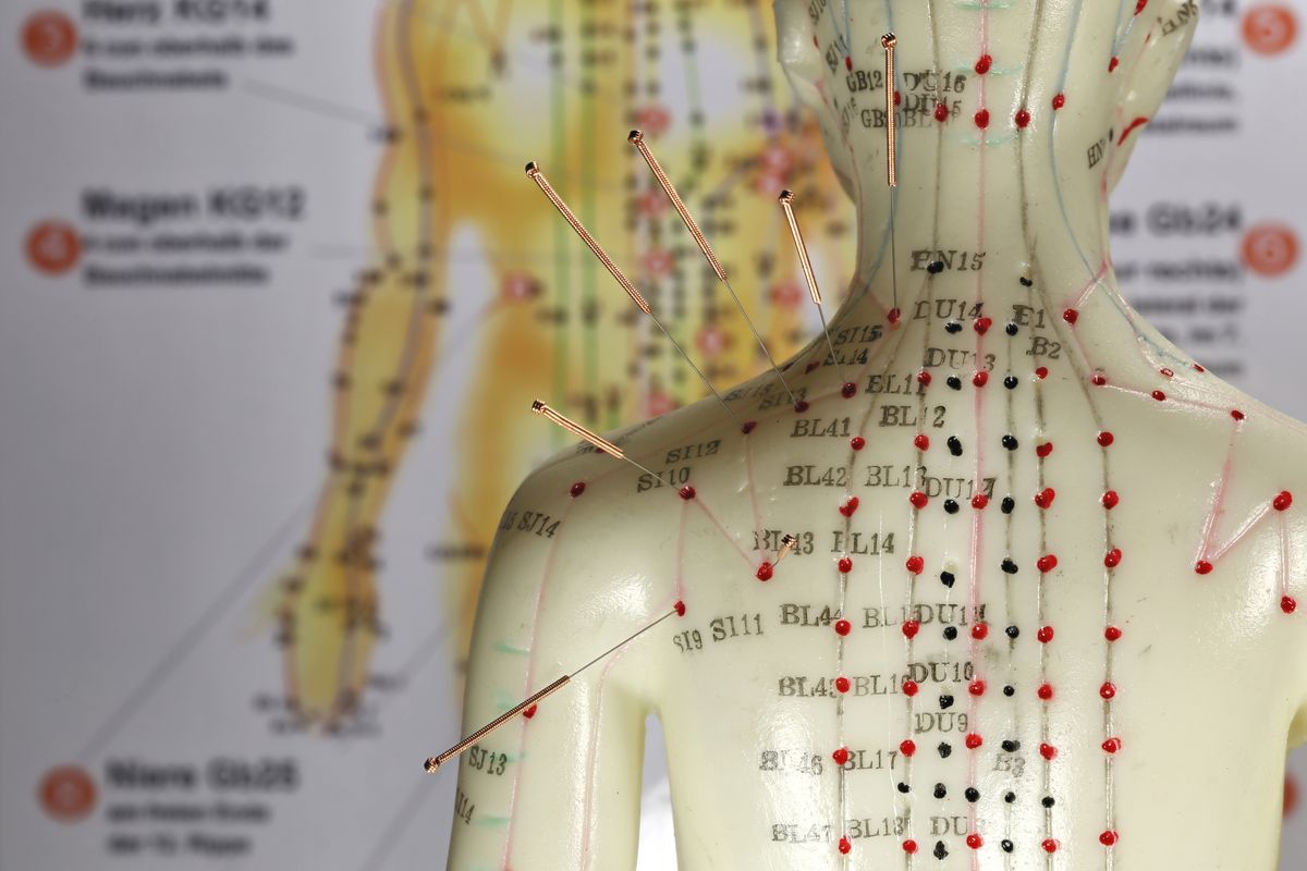 Co dokáže akupunktura?