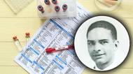 Zubožený, s oteklými genitáliemi a tělem plným vředů. Jak to bylo s teenagerem Robertem Rayfordem, první obětí AIDS