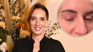 Lucie Šlégrová má jednu strašidelnou věc! Sperma do oka to prý vyléčí…